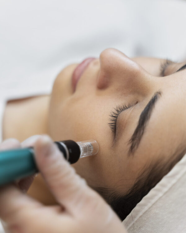 person-getting-micro-needling-beauty-treatment